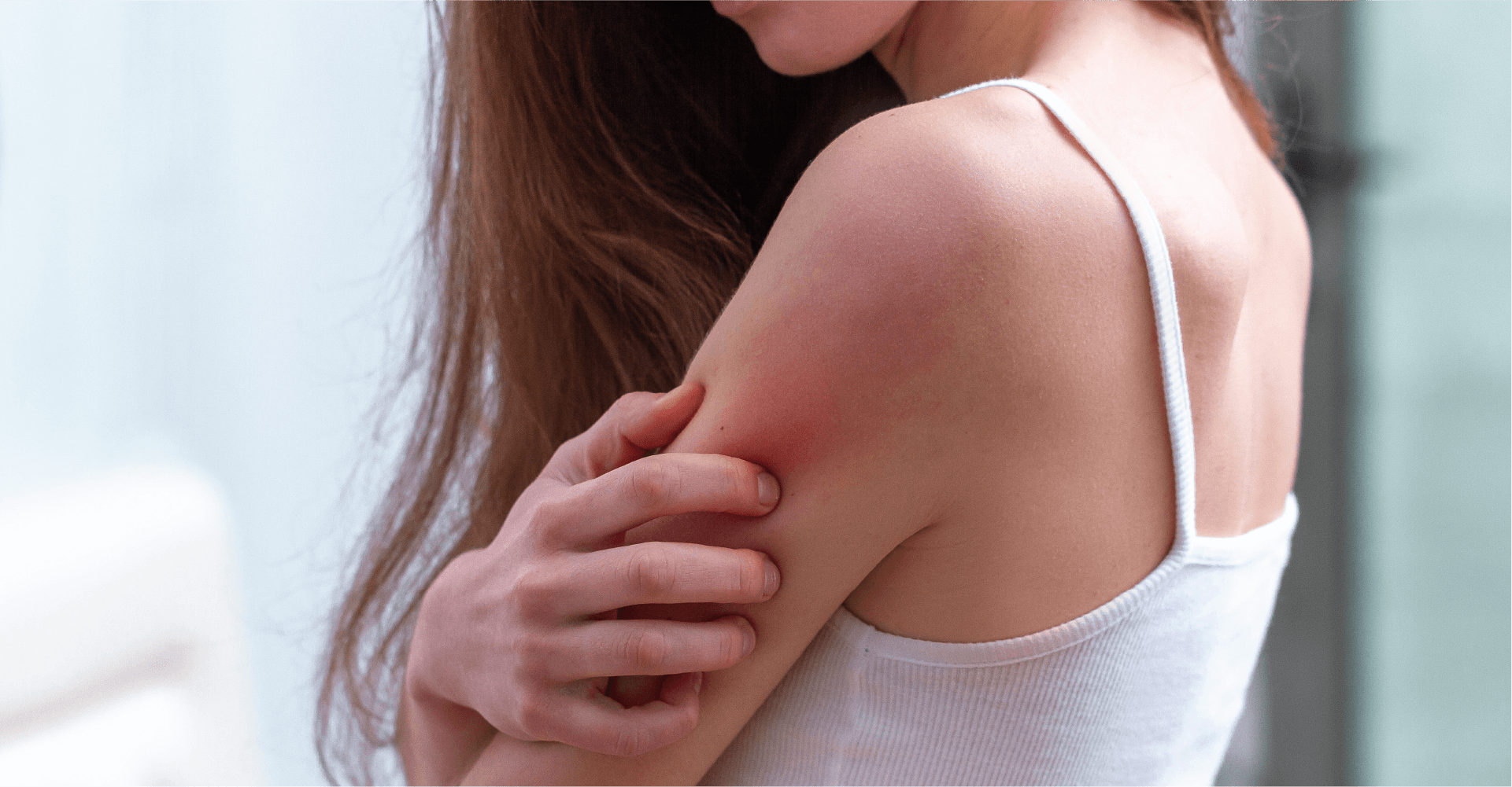 Effective Skin Infections Treatment Options - Sasha Clinic