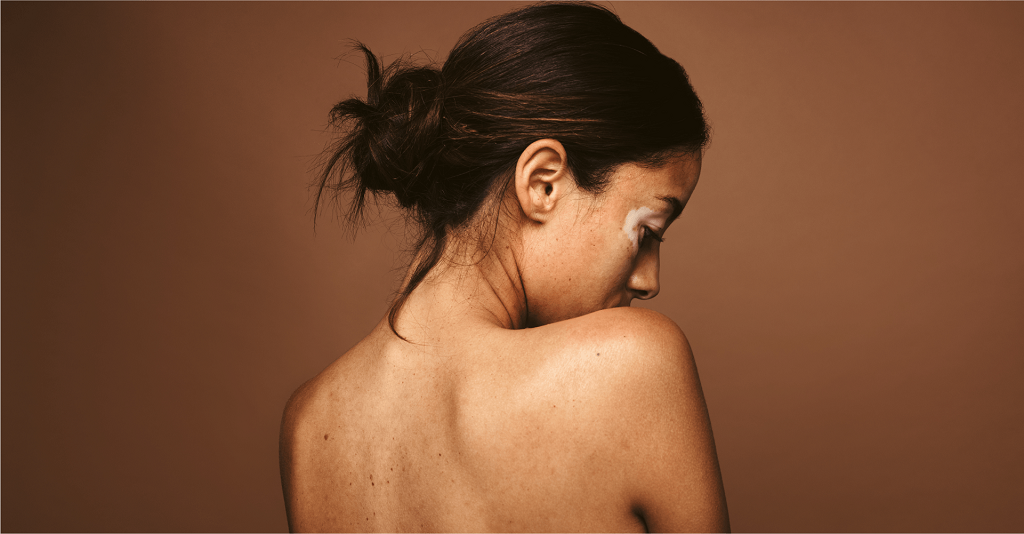 The Role of Environmental Stressors in Altering Skin Pigmentation - Sasha Clinics